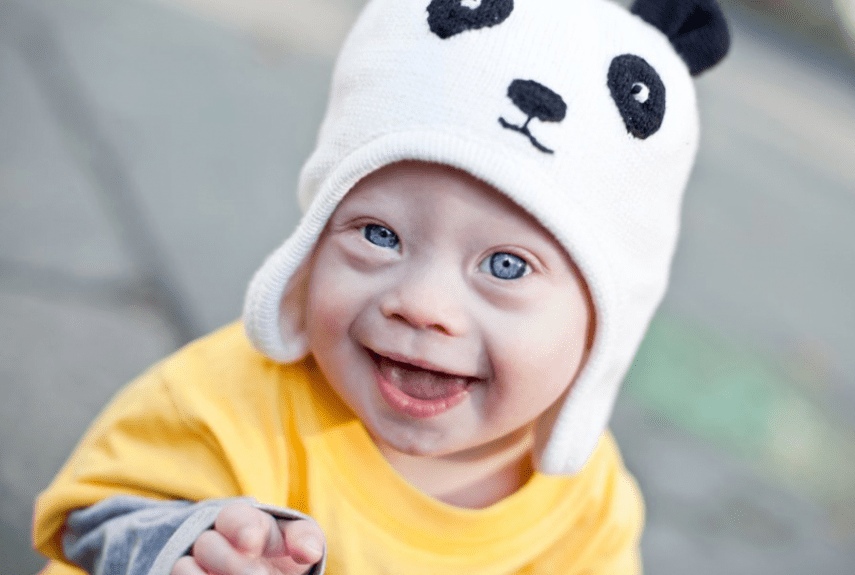 Развитие ребенка с синдромом Дауна: от 0 до 19 месяцев